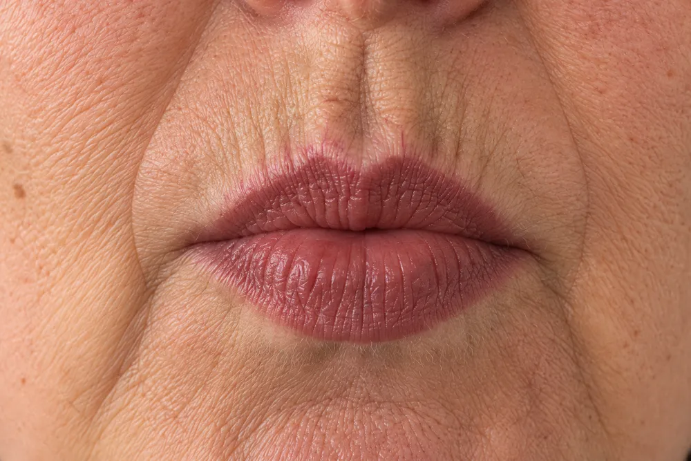 Nahaufnahme der Oberlippe: Der Lippenstift ist am Lippenrand in die feinen senkrechten Linien gelaufen